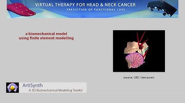 Biomechanical modelling using finite element models