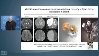 You contain multitudes: Somatic mutation and genomic diversity in human brain by NIH VideoCast 741 views 6 days ago 1 hour, 3 minutes