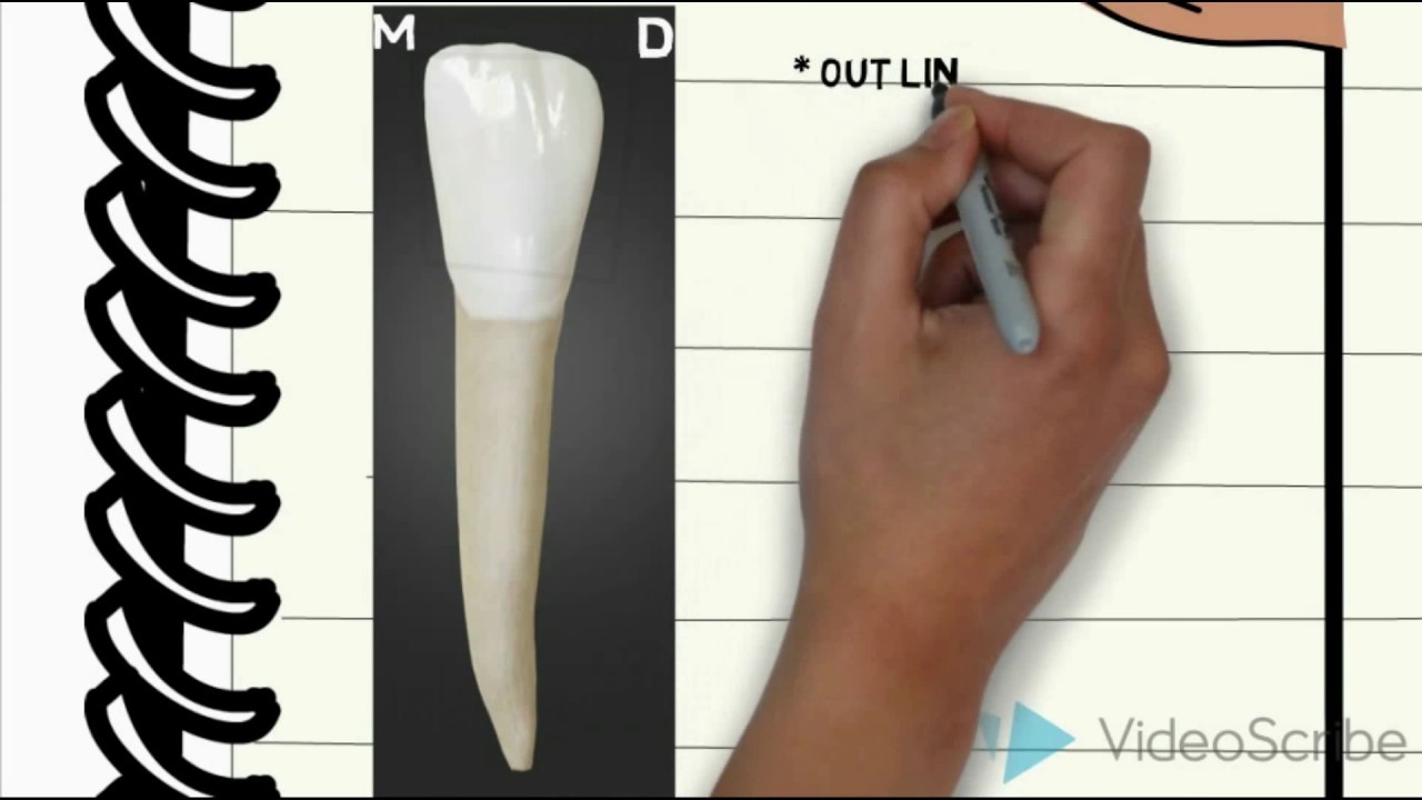 Carving Of Mandibular Lateral Incisor ( Lower 2 ) Fayoum University