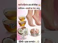 फटी एड़ियों (Cracked Heels) का रामबाण इलाज! Aloe Vera Gel Remedy 👣/ 100% gharelu nuskhe❣️#shortvideo