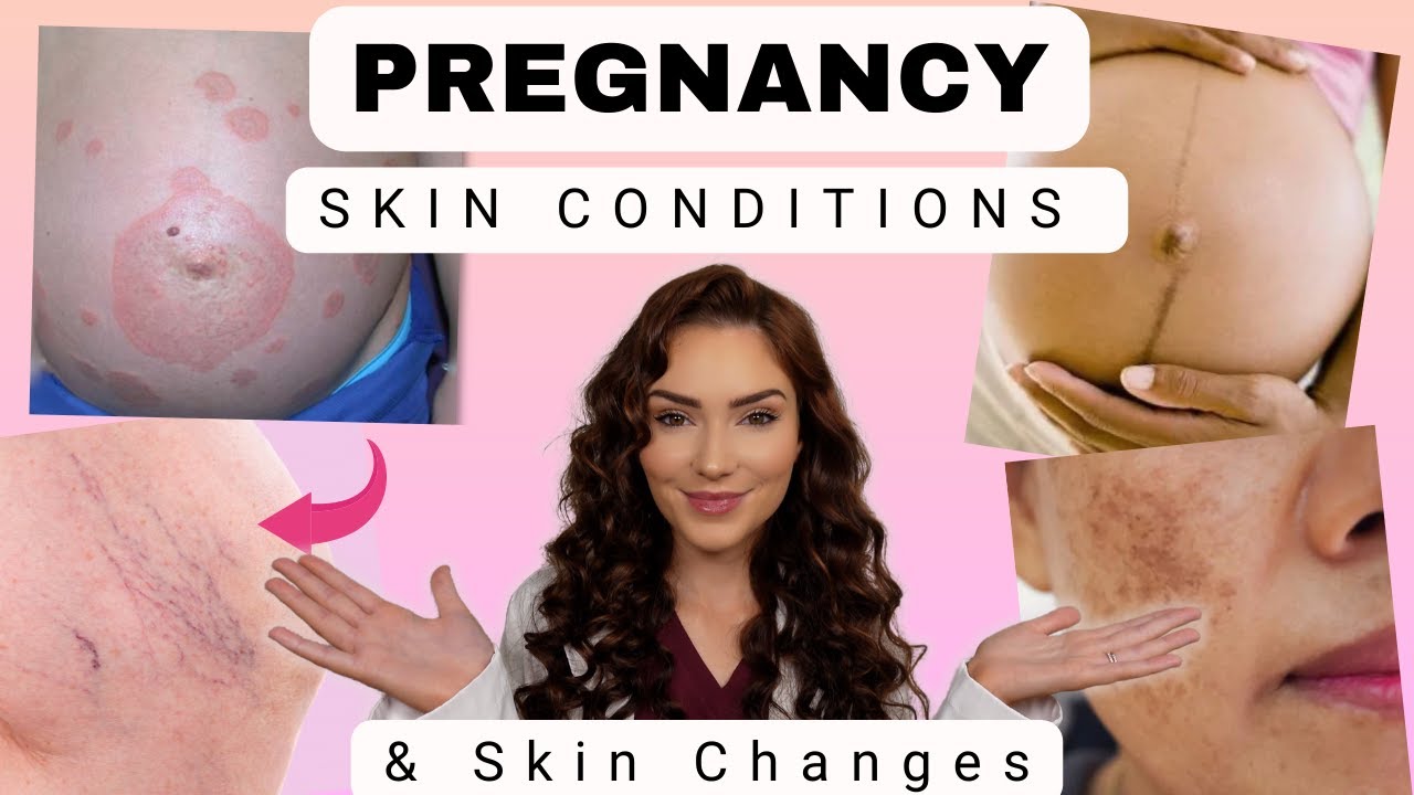 Can You Eat Pineapple While Pregnant? - Parents