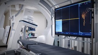 Thrombectomy: A Game-Changer in Stroke Treatment at Mary Washington Hospital