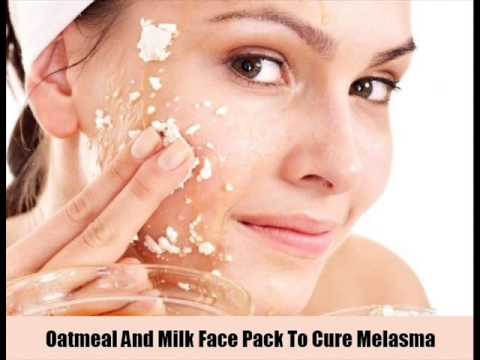 7 Natural Cures To Melasma