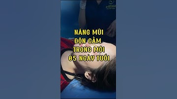 Nâng mũi độn cằm 05 ngày