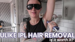 ULIKE IPL HAIR REMOVAL | Is it worth the hype??