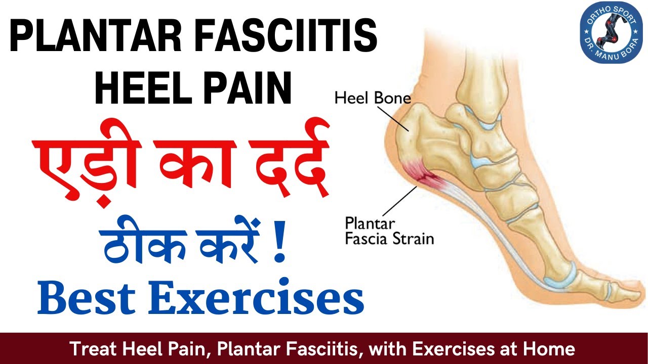 When Stubborn Heel Pain Isn't Plantar Fasciitis - Insoles and Orthotics -  Healthy Step