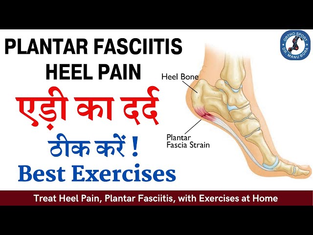 Plantar Fasciitis and Soccer