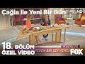 Saç dökülmesinin sebepleri neler? Çağla ile Yeni Bir Gün 18. Bölüm
