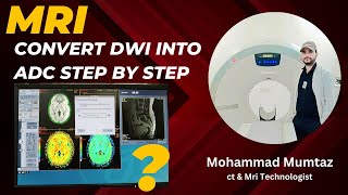 MRI - How to create DWI ( Diffusion weighted imaging) To ADC image by EGY matter step by step ||