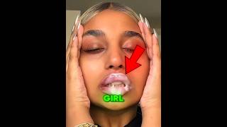She Used Too Much Lip Plumper 😱😲