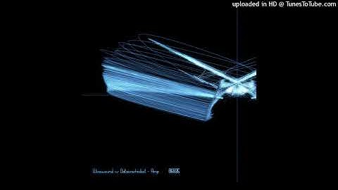 Wirewound vs. Datacrashrobot - Amp