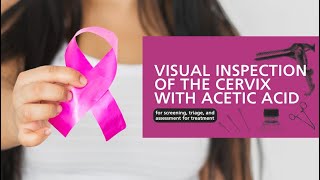 Celebrity Immertive's VR - Cervical Cancer Screening Using VIA Wealth