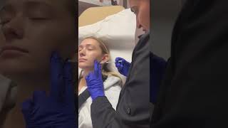 Masseter Botox with Dr. Macha !