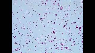 Brownian Motion