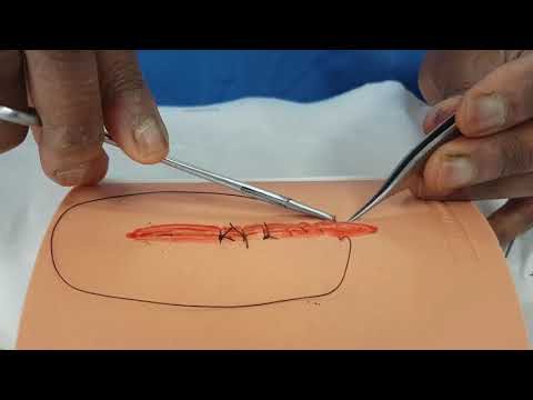 Suturing Skills: Continuous Suture