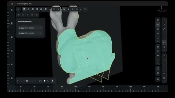 STLGauge Sectioning v0.4.8