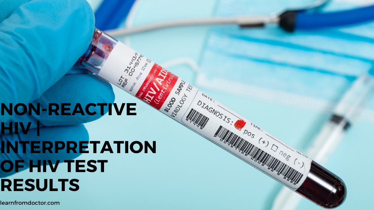 Нон спид. Non-Reactive Test. Nucleic acid Test HIV.