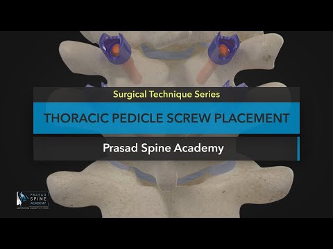 Video: Er pedicle screw mri trygge?