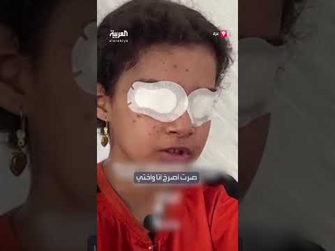 طفلة يمنية تتحدث عن فقدان عائلتها وتطالب بالمساعدة الطبية