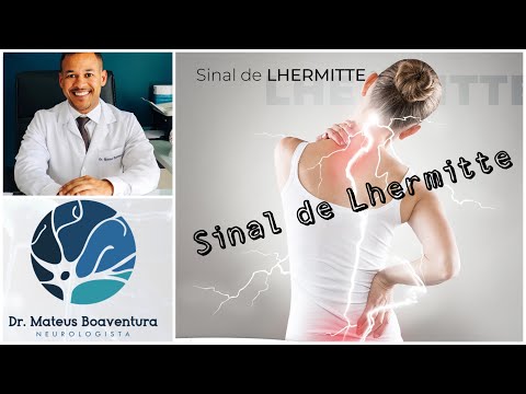 Vídeo: Sinal De Lhermitte E MS: O Que é E Como Tratá-lo