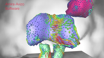 Biomedical brain research: DTI analysis with Amira Software