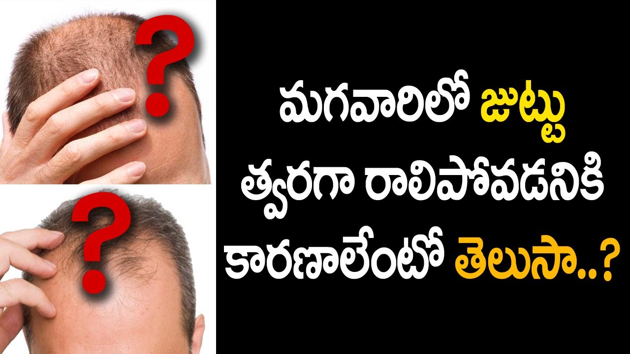 Causes For Hair Loss in Men. Tips for Improving Hair Growth | Health TV - YouTube