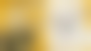 How to fix a proximal tibia fracture - quick step by step approach to ORIF plating