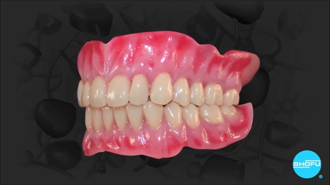 Monouso 100 Vassoi Per Impronte Dentali In Plastica Autoclavabili - Monouso, Assortiti, Per Laboratorio Odontoiatrico Vassoi Dentali Autoclavabili - Foto 2