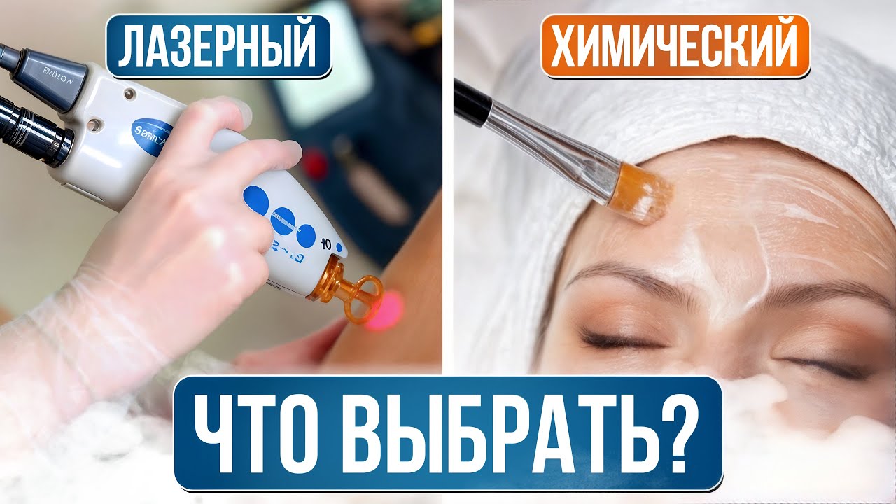 Пилинг, после которого РЕЗУЛЬТАТЫ ОСТАЮТСЯ НАДОЛГО! / Лазерный VS химический пилинг: что выбрать?