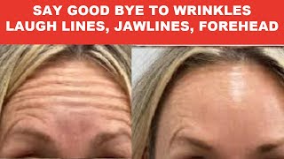 SKINCARE TIPS, Anti-Aging, Dark Circles, Eye Bags, Reduce Wrinkles, Boost Collagen