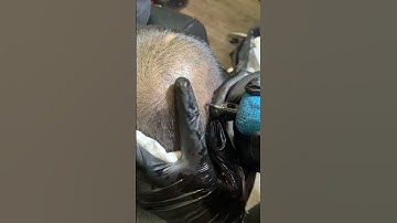 XĂM CHÂN TÓC CHO NGƯỜI HÓI | CHỮA HÓI ĐẦU | RIO TATTOO STUDIO