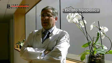 Quantas pessoas tem síndrome de Klinefelter?