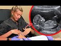 Top 10 Red Flags About Hailey Biebers Pregnancy