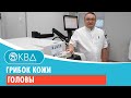 166  Грибок кожи головы