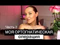 МОЯ ОРТОГНАТИЧЕСКАЯ ОПЕРАЦИЯ:дневник реабилитации,стоимость,фото до/после