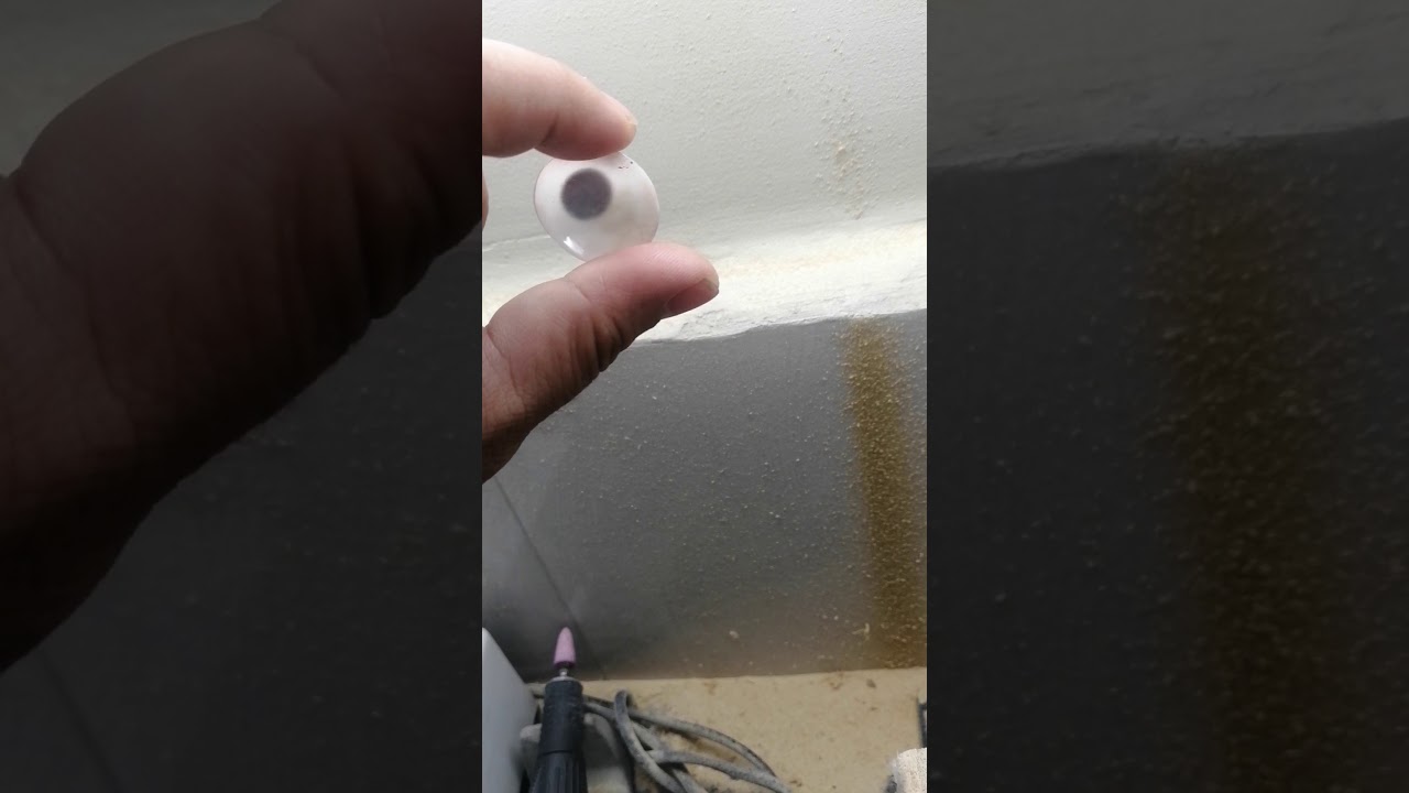 Top one Artificial Eye Lab in Bangladesh