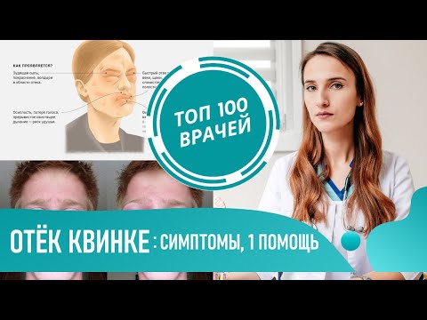 Как выглядит Отёк Квинке: фото, симптомы, первая помощь в домашних условиях. Ангионевротический отёк