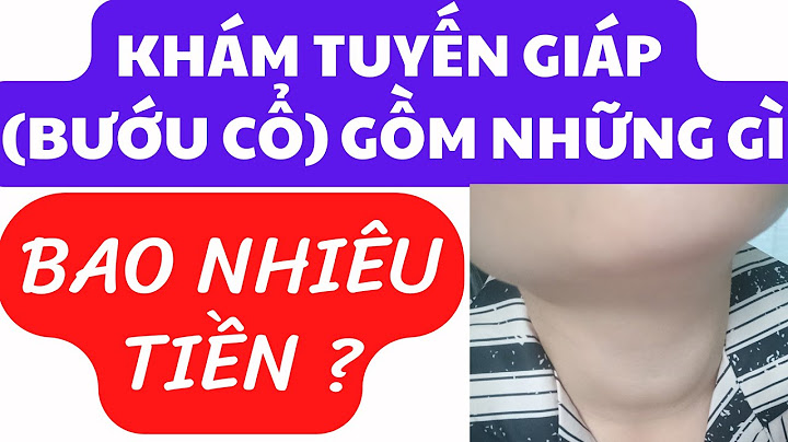 Khám tuyến giáp hết bao nhiêu tiền năm 2024