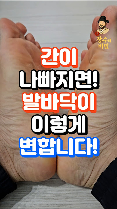 간이 나빠지면 발바닥이 이렇게 변합니다!! #중년건강 #건강한중년 #건강정보 #지식 #장수의비밀 #건강관리 #건강상식 #건강 #50대건강