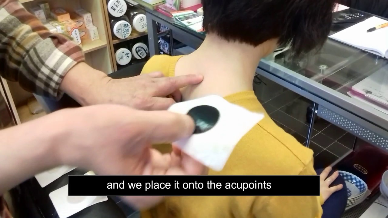 San Fu Moxibustion - YouTube