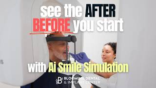 See the AFTER before you start with our AI smile simulation 😁✨ #dentalimplants #Aisimulation