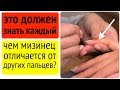 МИЗИНЕЦ расскажет о вашем здоровье!