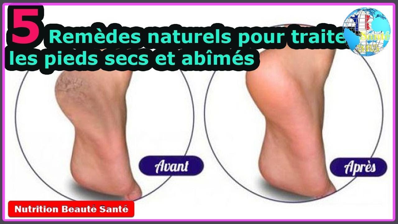 5 Remèdes naturels pour traiter les pieds secs et abîmés|Nutrition