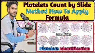 Manual platelet count slide method|Platelets count of Slide Method|platelets Count #platelets #lab