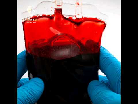 انتقال عجیب خون از جسد به انسان اتفاقی که باعث کشف راه های نوین نگهداری خون شد