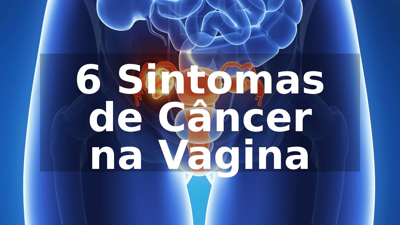 Sintomas de cancer de ano