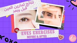 EYE Exercises Results! Before and After pics | نتائج تمارين العين! صور قبل وبعد