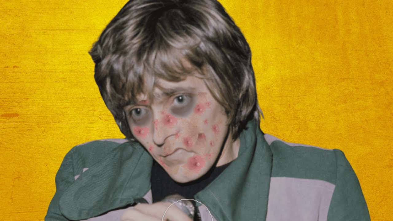 Билли Фьюри перенес болезнь, которая убила его в возрасте 43 лет