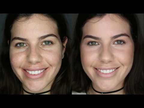 Scars & pigmentation from acne: Create a natural cover up look camera iphone 8 plus apk