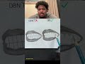 How to Draw Teeth